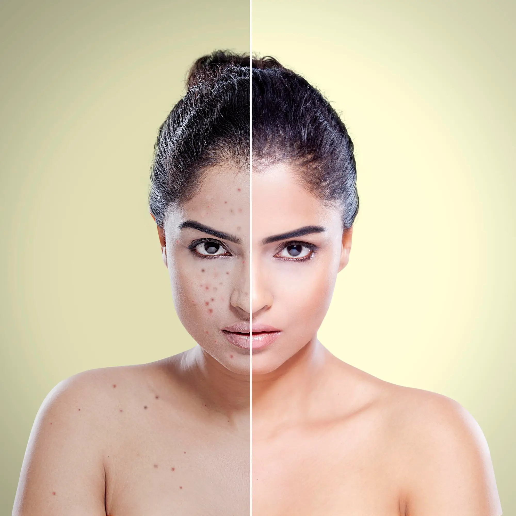 before-after